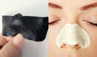 鼻子有黑头怎么去除